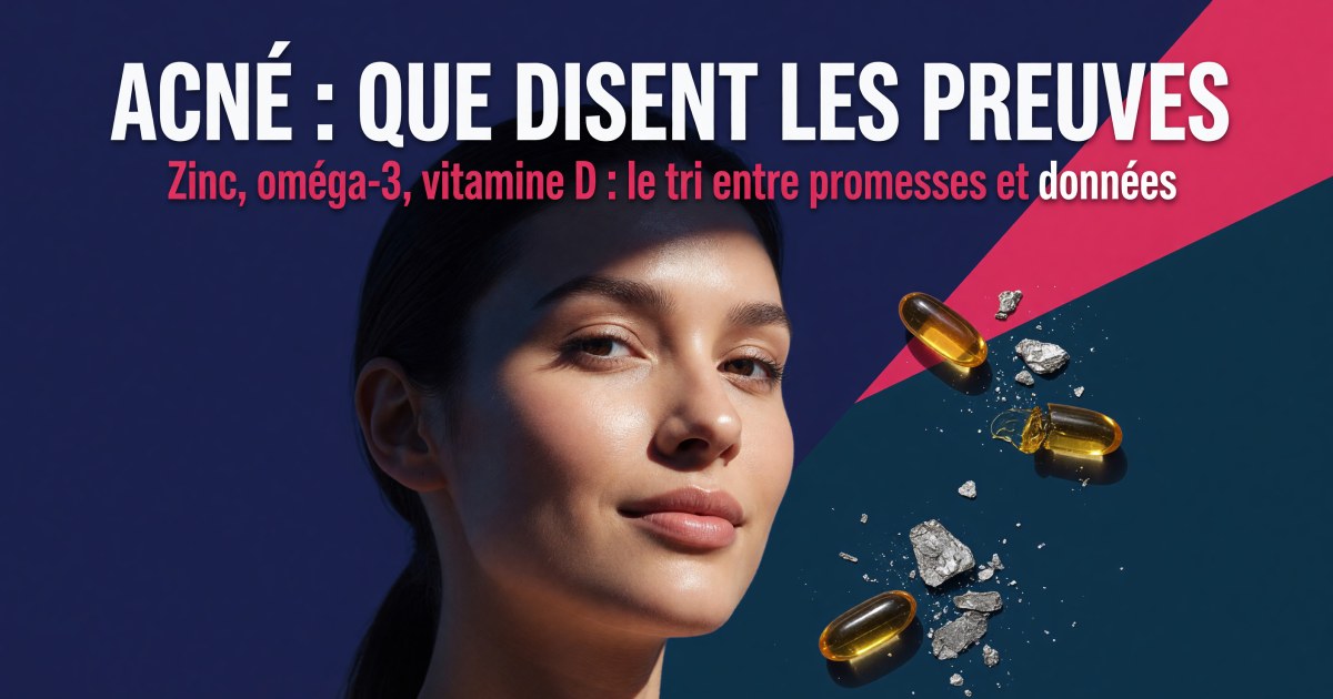Acné de l'adolescent et du jeune adulte : quels compléments selon les preuves ?