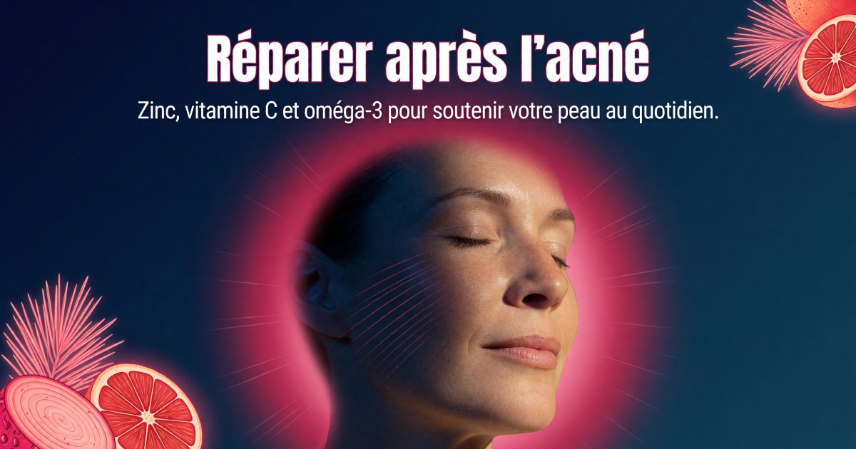 Marques d'acné : quels compléments pour soutenir la réparation de la peau ?