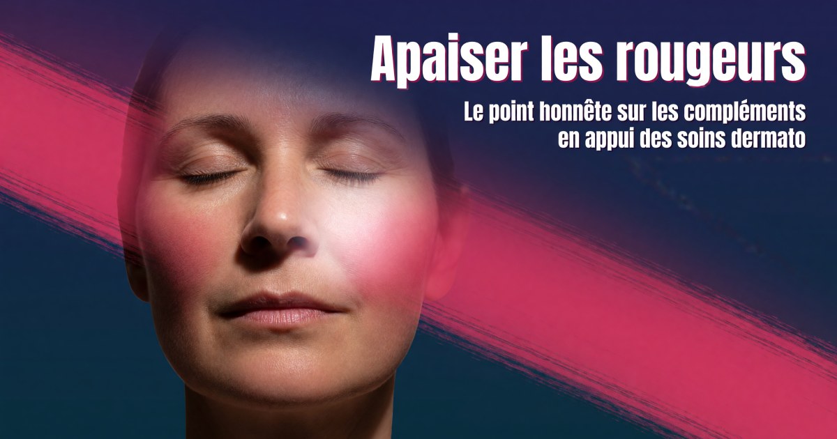 Rosacée et couperose : quels compléments alimentaires selon les preuves