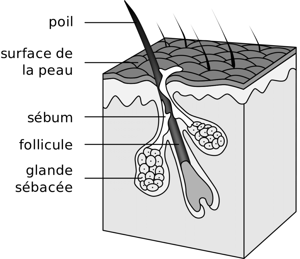 comment soigner l'acné - IGF1 et acné