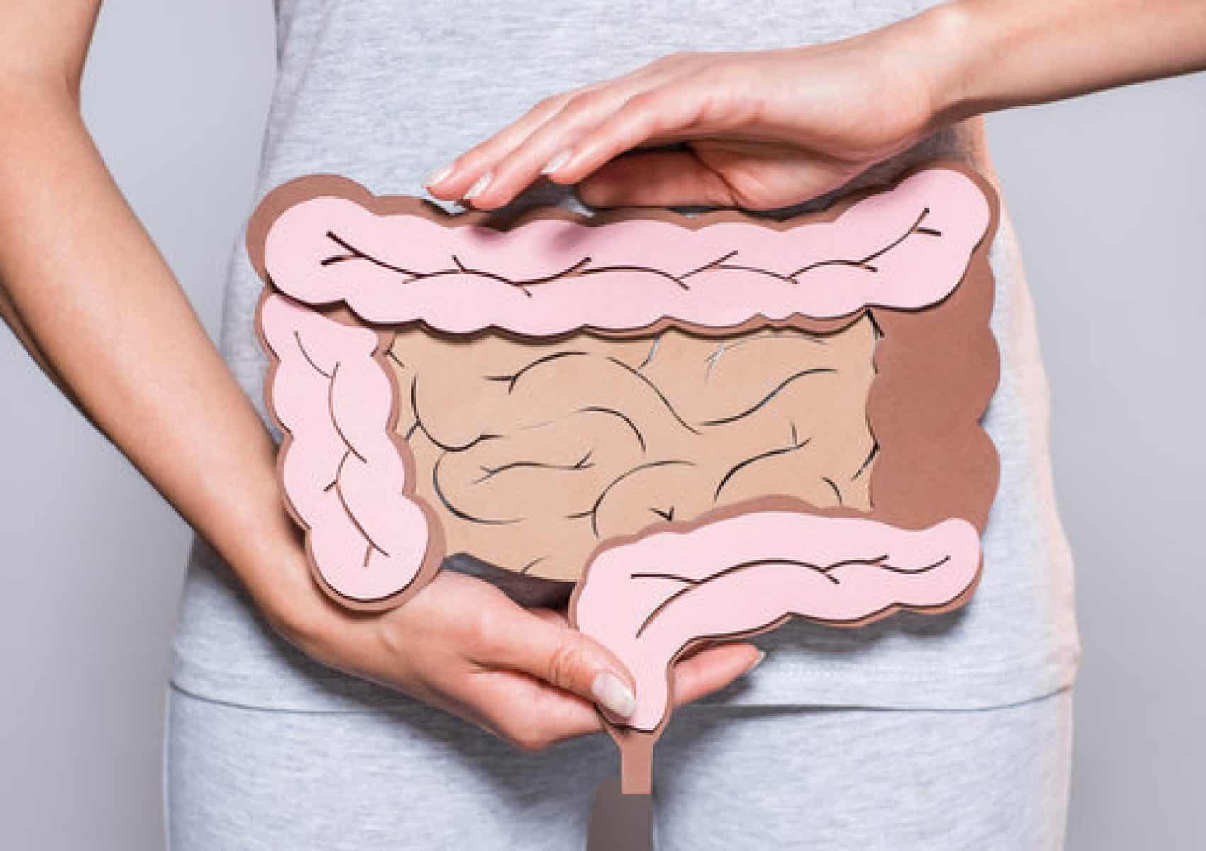 Cancer du colon