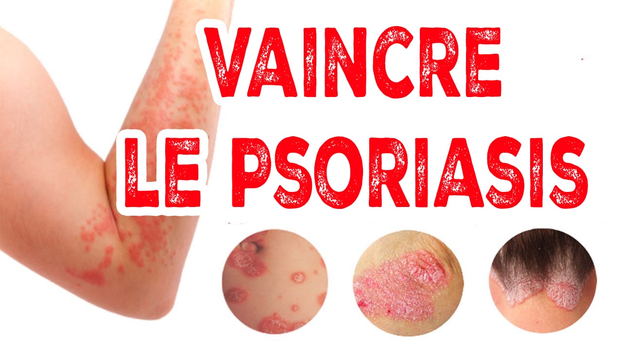 Comment vaincre le PSORIASIS - BMoove