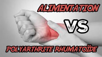 soigner POLYARTHRITE RHUMATOÏDE