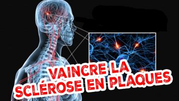 guérir SCLÉROSE EN PLAQUES