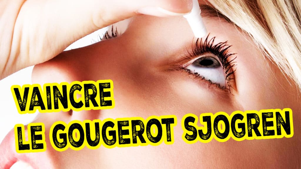 gougerot-sjogren