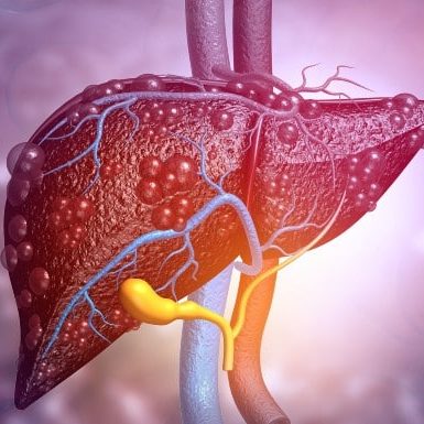 douleur au foie : est-ce que les hépatites sont à l'origine de la douleur ?