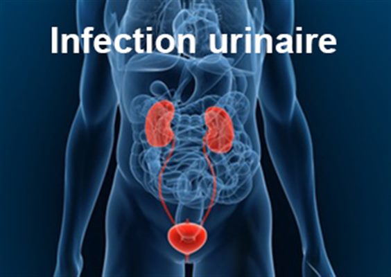 infection urinaire causée par le candida albicans 