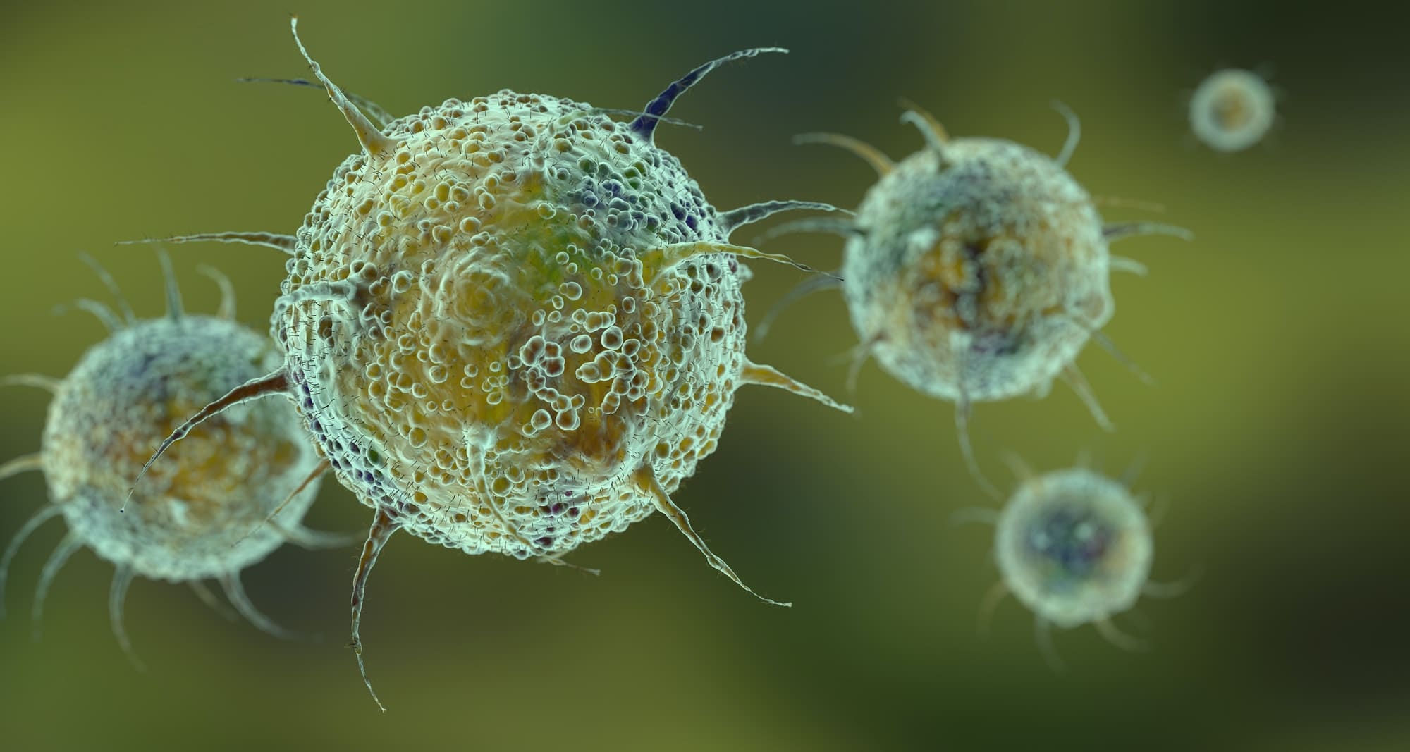 Maladies auto-immunes