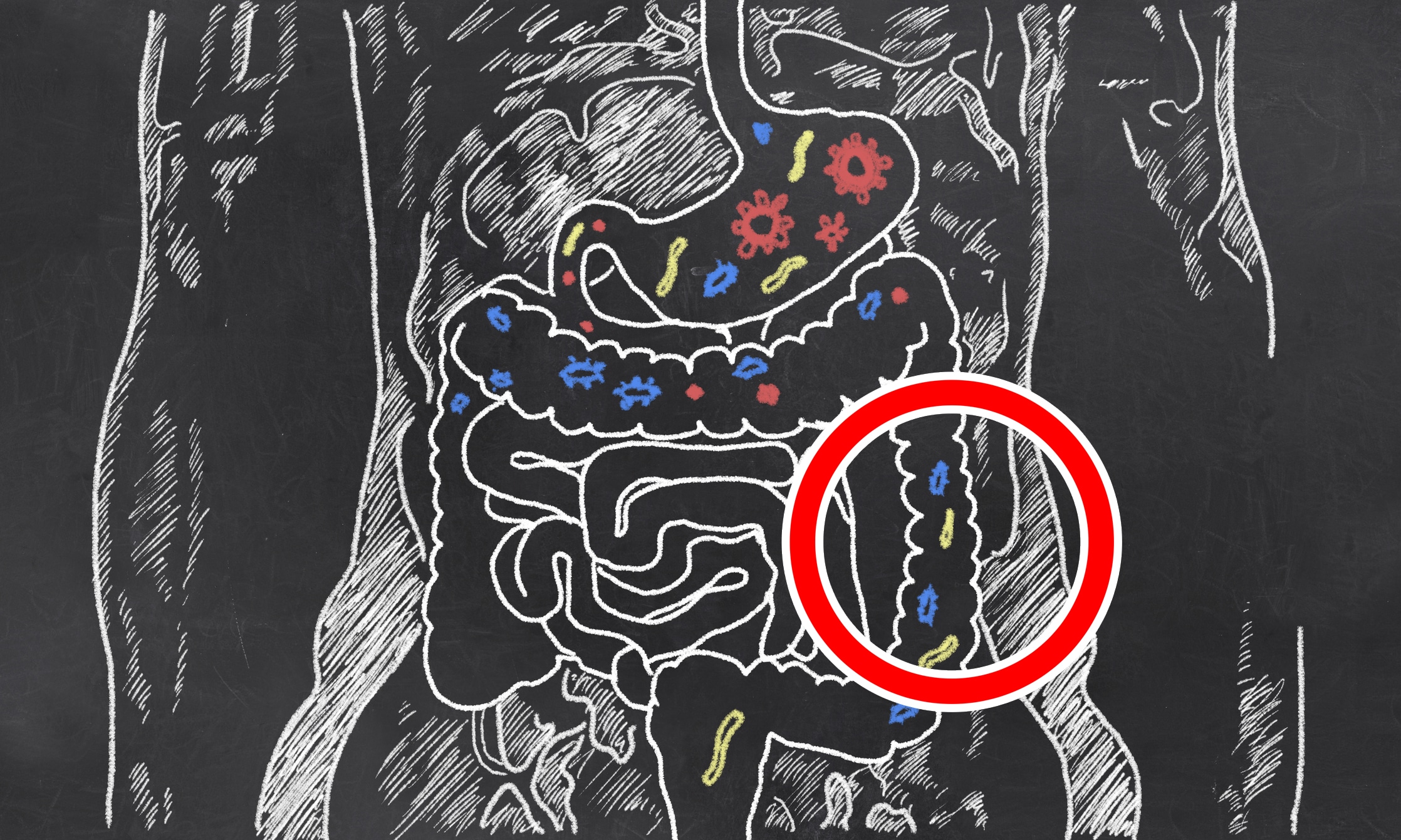 perméabilité intestinale - signes et symptômes